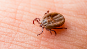 Kleszcz na skórze, którego ukąszenie może skutkować boleriozą