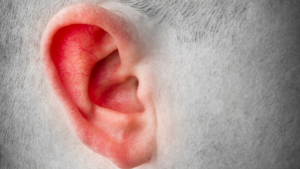 Gdy lewe ucho piecze często jest czerwone