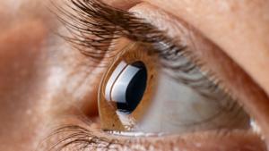 Oko, osoby chorej na astygmatyzm